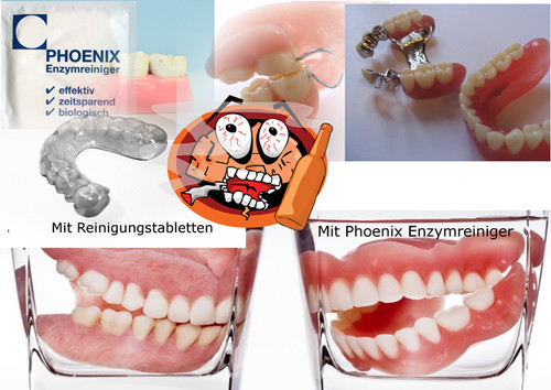 Enzymreiniger zahnprothese - enzymreiniger,