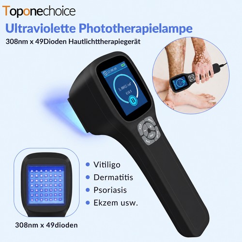 308nm uvb lichttherapie - uvb, lampe