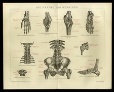 Original Holzstich 1882