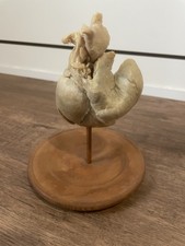 ECHTES Herz plastiniert