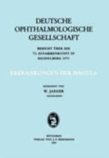 Erkrankungen Der Macula 