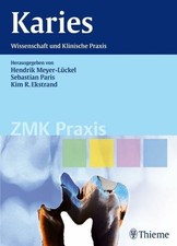 Karies: Wissenschaft und