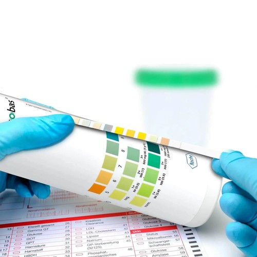 Roche combur test - combur, 3