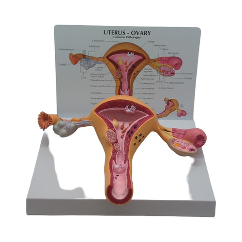Gpi anatomicals uterus ovar - gpi, uterus-ovar