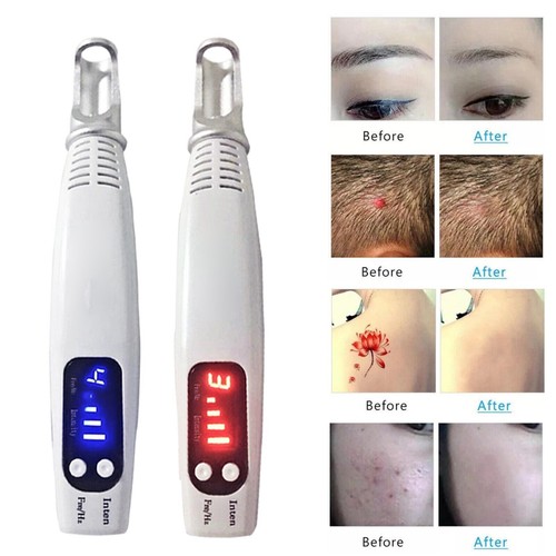 Licht laser picosekundenstift - laser,