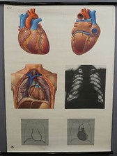 Schulwandkarte Lehrtafel Anatomie des Menschen Herz Organ Rollbild Poster