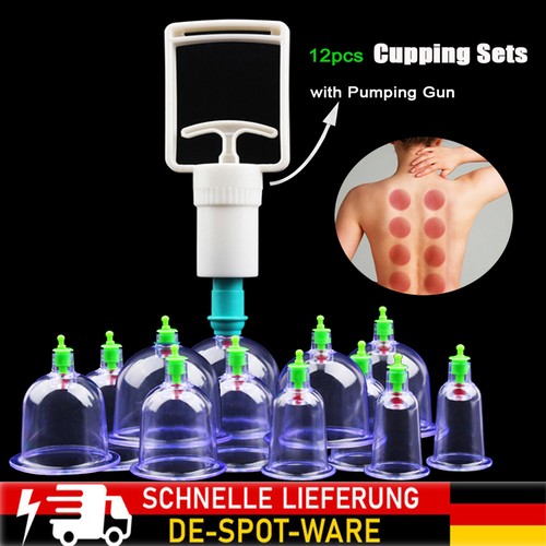 Schröpfen gläser set vakuum - set,