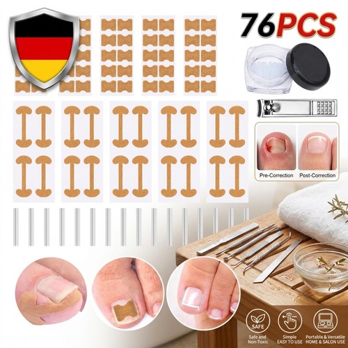 Zehennagel korrektur - zehennagel,