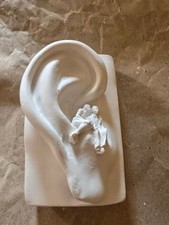 Gips Ohr Figuren sitzen am Ohr