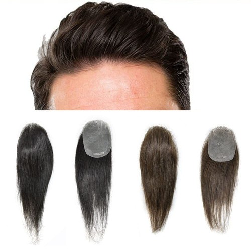 Haar patch toupet haarpflaster - haar,