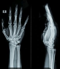 20 Original Röntgenbilder, Röntgenfilme 20x (u.a. Hand, Hüfte., HWS, BWS, LWS)