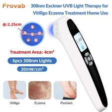 Targeted 308nm Light Therapy
