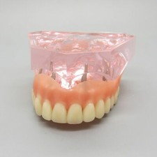 Dental Modell der oberen