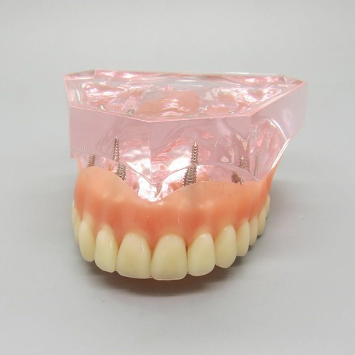 Dental modell der oberen - modell,