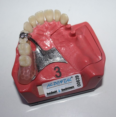 Dent schaumodell - schaumodell,