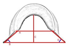 Kopfeisen für baumloser