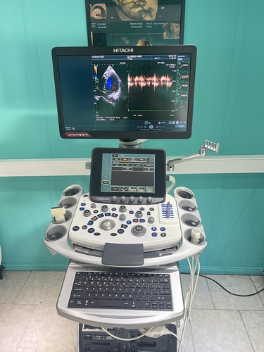 Hitachi aloka arietta 850 - hitachi,