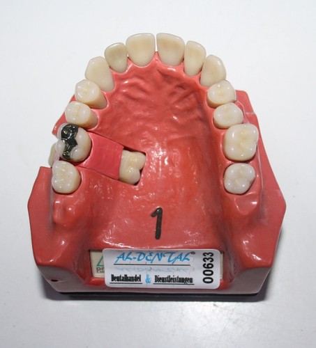 Dent schaumodell - go,