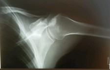 15 tlg. Röntgenbilder, Original Röntgenfilme 15 St. (u.a. Hüfte., HWS, BWS, LWS)