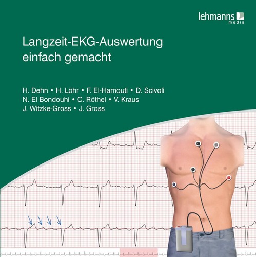 Langzeit-EKG-Auswertung