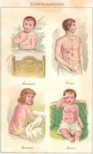 Kinderkrankheiten. Bilz