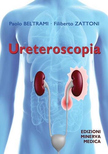 Ureteroskopie