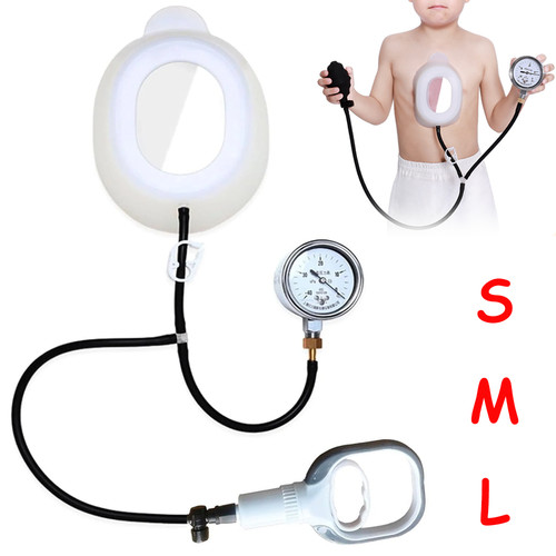 Pectus excavatum vakuumglocke - excavatum,