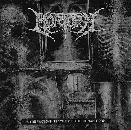 Mortopsy putrefactive states - putrefactive,