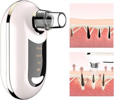 Mitesser Entfernung Porensauger,Porenreiniger Entferner gesicht sauger Mitesser.