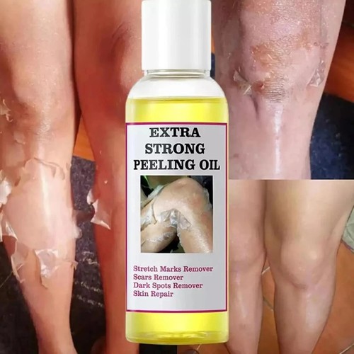 Yellow peeling oil original - -,
