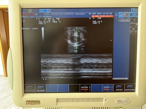 Ultraschallgerät esaote mylab - ultraschallgerät,