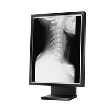 NEC MD21GS-2MP 21,3" LCD TFT