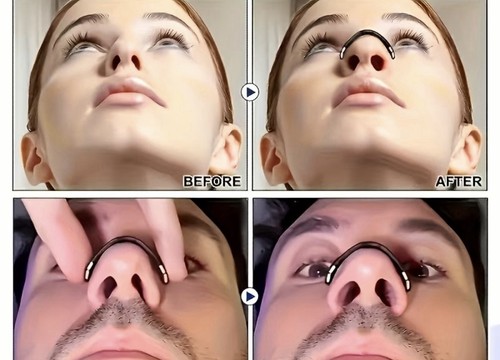 Premium nasenclips - premium,