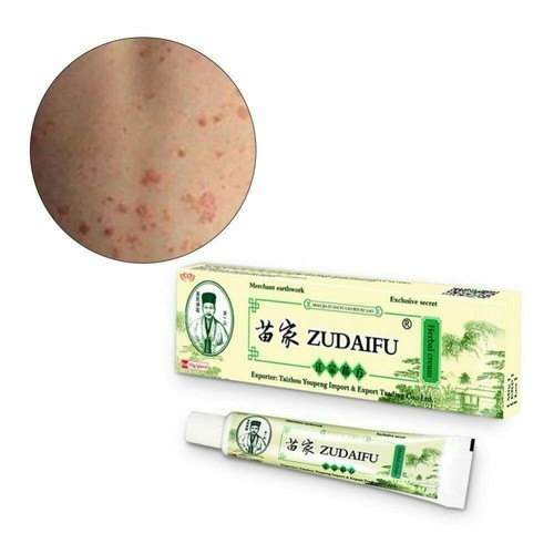 Itching cream chinesische - cream,