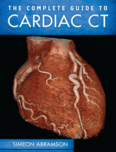 The complete guide cardiac - complete,