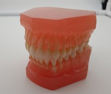 Zahnmodell mit herausnehmbaren Zähnen (zum aufklappen)  als Demonstrator