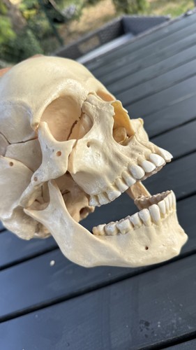 Somso medical teaching skull - somso,