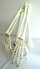 Zwei Anatomische Hand - Arm - Knochen Modelle Originalgröße rechts links