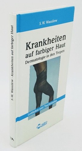 Krankheiten auf farbiger haut - auf,