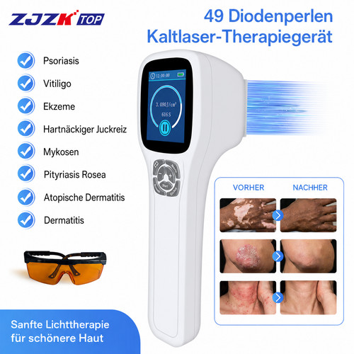 Medical 308nm phototherapy - 308nm,