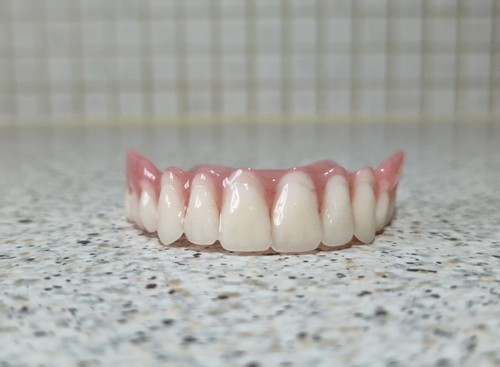 Zahnprothese,zahnersatz,prothe