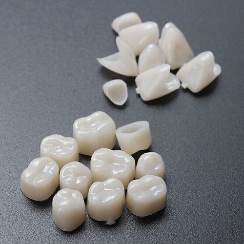 115 teiliges provisorisches - 115-teiliges,