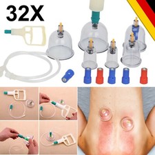 Schröpfen Set für Vakuum Massage mit 32tlg Schröpfgläser Rohr Cupping Schröpfset