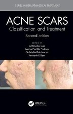 Acne Scars - 9781138894228