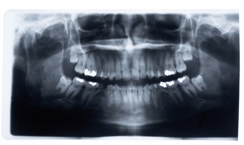 Original dental panorama - original,
