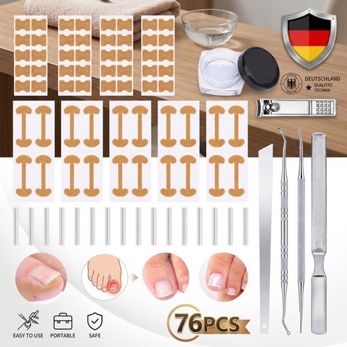 Eingewachsener zehennagel - eingewachsener,