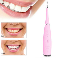 Elektrischer Zahnsteinplaque Zahnsteinentferner Zähne Zahnfleckenreiniger