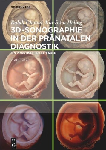 Sonographie der - 3d-sonographie,