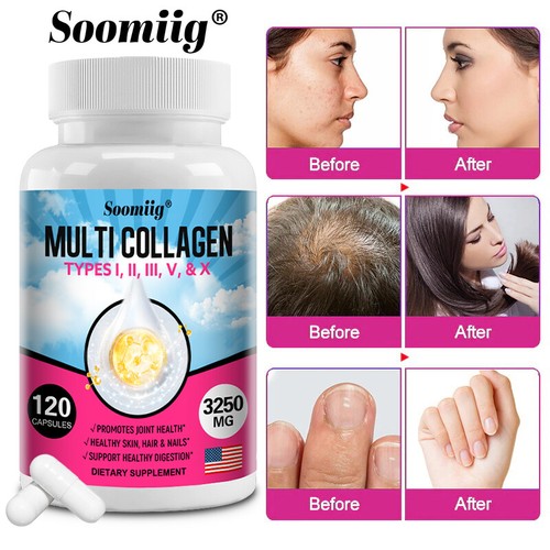 Collagen kapseln hochdosiert - collagen,