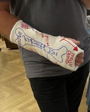 Massiver Gipsarm SAFS m